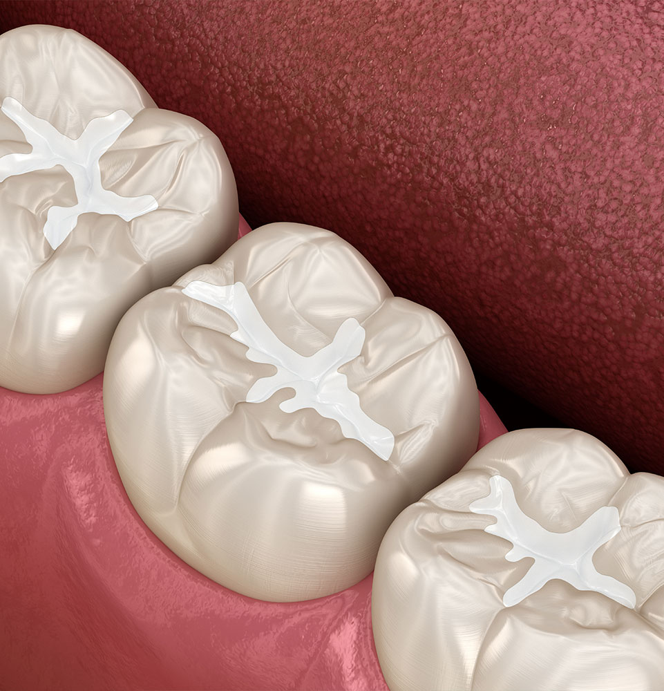 close up of graphic of sealant